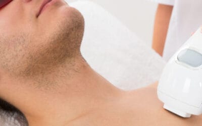 What To Expect At Your First Laser Hair Removal