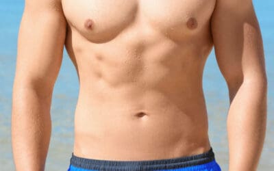 How Men are Losing Weight with the Zerona Laser